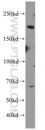 NISCH Antibody in Western Blot (WB)