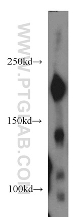 NISCH Antibody in Western Blot (WB)