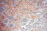 DIXDC1 Antibody in Immunohistochemistry (Paraffin) (IHC (P))