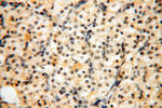 DIXDC1 Antibody in Immunohistochemistry (Paraffin) (IHC (P))