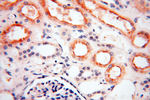 DIXDC1 Antibody in Immunohistochemistry (Paraffin) (IHC (P))