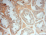 DIXDC1 Antibody in Immunohistochemistry (Paraffin) (IHC (P))