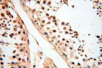 DIXDC1 Antibody in Immunohistochemistry (Paraffin) (IHC (P))