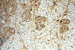 DIXDC1 Antibody in Immunohistochemistry (Paraffin) (IHC (P))