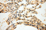 DIXDC1 Antibody in Immunohistochemistry (Paraffin) (IHC (P))