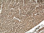 DIXDC1 Antibody in Immunohistochemistry (Paraffin) (IHC (P))