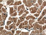 DIXDC1 Antibody in Immunohistochemistry (Paraffin) (IHC (P))