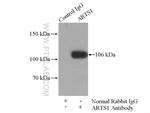 ARTS1 Antibody in Immunoprecipitation (IP)