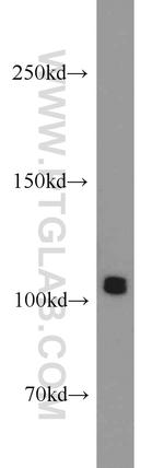 ARTS1 Antibody in Western Blot (WB)