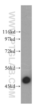 ARP3 Antibody in Western Blot (WB)