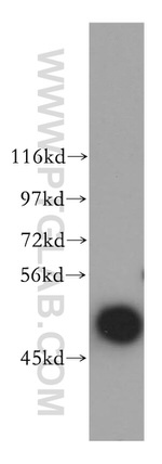 ARP3 Antibody in Western Blot (WB)