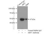 ARP3 Antibody in Immunoprecipitation (IP)