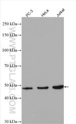 ARP3 Antibody in Western Blot (WB)