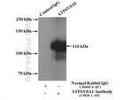 ATP6V0A1 Antibody in Immunoprecipitation (IP)