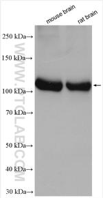 ATP6V0A1 Antibody in Western Blot (WB)