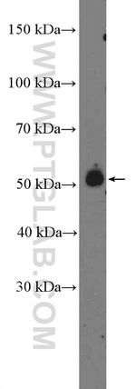 HTR7 Antibody in Western Blot (WB)