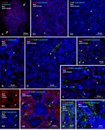 Connexin 32 Antibody in Immunohistochemistry (IHC)