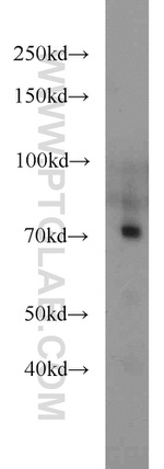 TCF7L2 Antibody in Western Blot (WB)