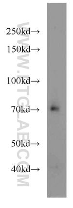 TCF7L2 Antibody in Western Blot (WB)