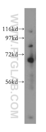 TCF7L2 Antibody in Western Blot (WB)