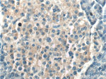 TAC1 Antibody in Immunohistochemistry (Paraffin) (IHC (P))