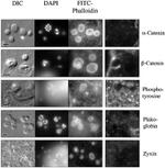 beta Catenin Antibody in Immunocytochemistry (ICC/IF)