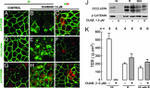 beta Catenin Antibody in Western Blot, Immunohistochemistry (WB, IHC)