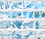 beta Catenin Antibody in Immunohistochemistry (Paraffin) (IHC (P))