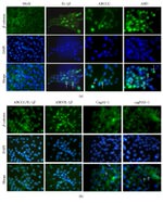 beta Catenin Antibody in Immunocytochemistry (ICC/IF)