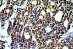 SAP18 Antibody in Immunohistochemistry (Paraffin) (IHC (P))