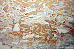 RND2 Antibody in Immunohistochemistry (Paraffin) (IHC (P))