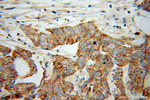 RND2 Antibody in Immunohistochemistry (Paraffin) (IHC (P))