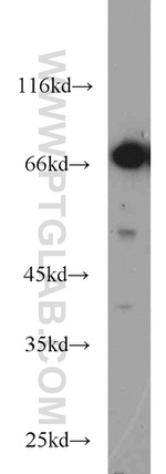 JAKMIP1 Antibody in Western Blot (WB)