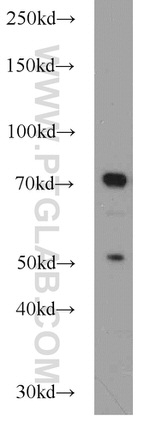 JAKMIP1 Antibody in Western Blot (WB)