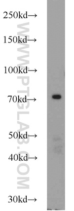 JAKMIP1 Antibody in Western Blot (WB)