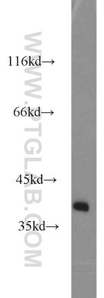 SH3GL3 Antibody in Western Blot (WB)