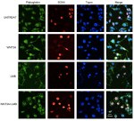 gamma Catenin Antibody in Immunocytochemistry (ICC/IF)