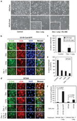 CDH11 Antibody in Immunocytochemistry (ICC/IF)