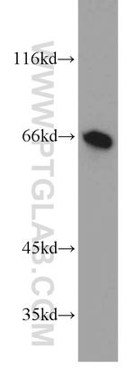 UBP1 Antibody in Western Blot (WB)