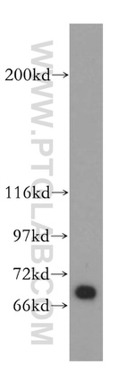 UBP1 Antibody in Western Blot (WB)