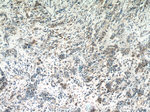 AEG-1/MTDH Antibody in Immunohistochemistry (Paraffin) (IHC (P))