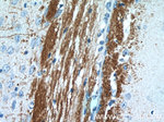 AEG-1/MTDH Antibody in Immunohistochemistry (Paraffin) (IHC (P))