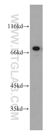 AEG-1/MTDH Antibody in Western Blot (WB)