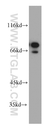 AEG-1/MTDH Antibody in Western Blot (WB)