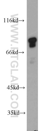 AEG-1/MTDH Antibody in Western Blot (WB)