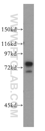 AEG-1/MTDH Antibody in Western Blot (WB)