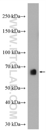 AEG-1/MTDH Antibody in Western Blot (WB)