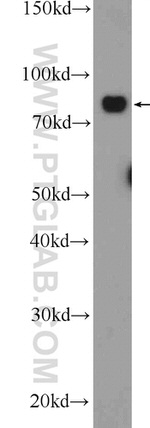 AEG-1/MTDH Antibody in Western Blot (WB)