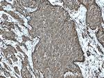 AEG-1/MTDH Antibody in Immunohistochemistry (Paraffin) (IHC (P))