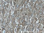 AEG-1/MTDH Antibody in Immunohistochemistry (Paraffin) (IHC (P))